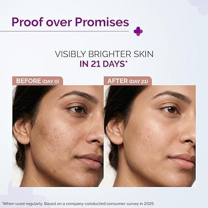 No Brand The Derma Co 10% Advanced Vitamin C Face Serum with 5% Niacinamide 30ml | Dark Spot & Pigmentation Serum daily… — thumbnail 7 of 10