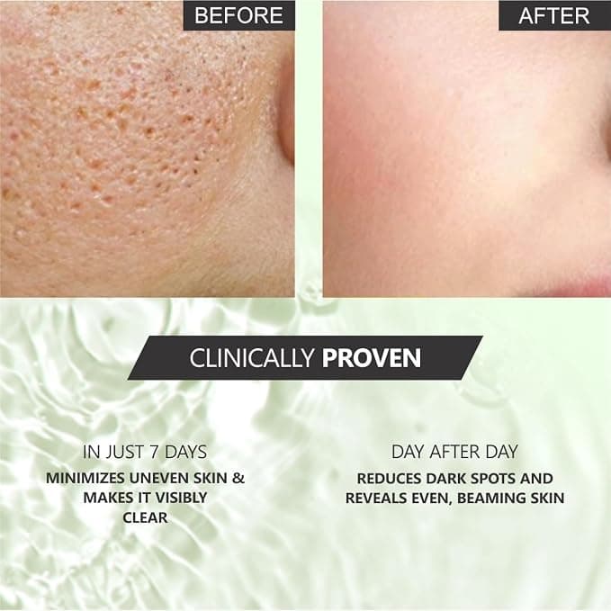 No Brand Lord's Secrets of Korean Glass Skin Rice Water Brightening Toner 100ml | Hydrating & Brightening Face Toner daily… — thumbnail 2 of 5