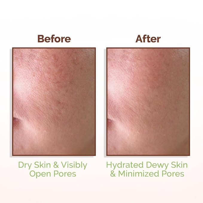 Mamaearth Mamaearth Rice Water Dewy Face Toner 150ml | Hydrating & Brightening Toner with Rice Water, Niacinamide & Aloe… — thumbnail 4 of 6